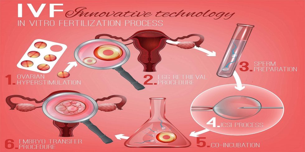 Ivf Procedure Step By Step Ivf Process Start To Finish 