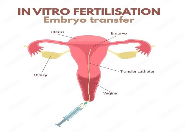 9 Positive Signs After Embryo Transfer Dr Mona Dahiya