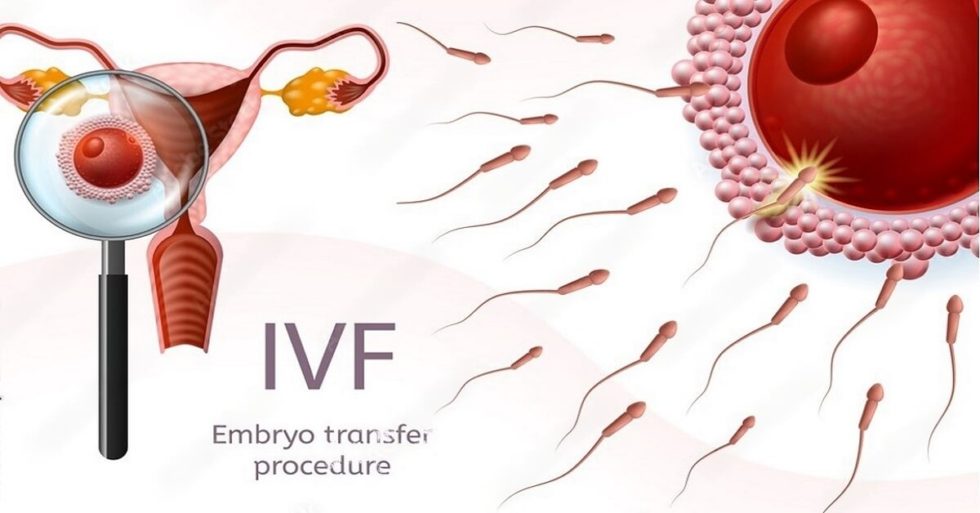 What Is Embryo Transfer Technology