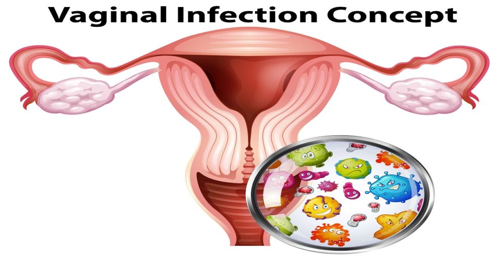 How Does Vaginal Infections Affect Fertility? - Dr. Mona