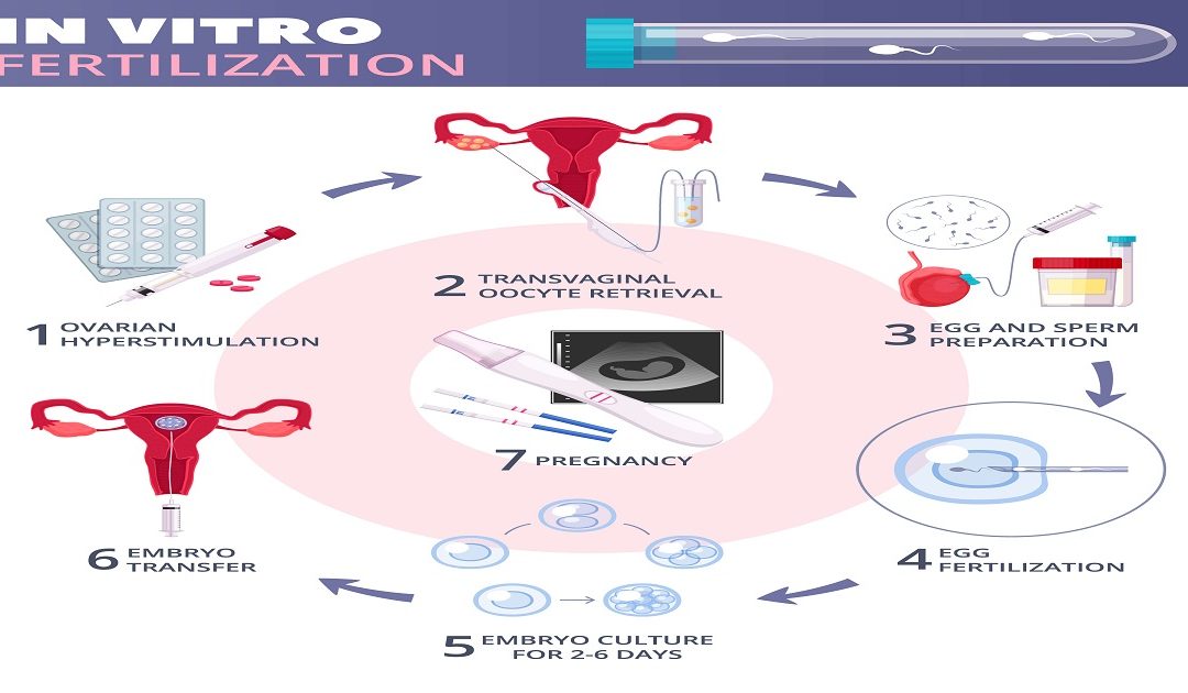 How Long Does IVF Take from start to finish?