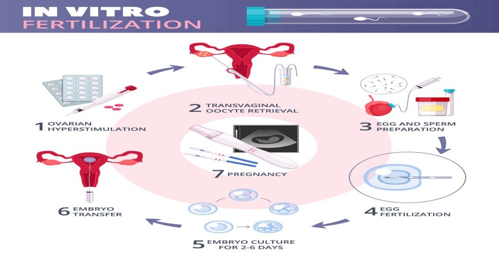 Ivf Timeline How Long Does Ivf Take From Start To Finish 6147