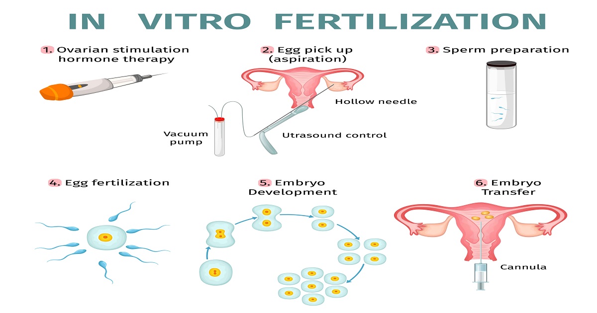 Difference Between Mild IVF vs Conventional IVF
